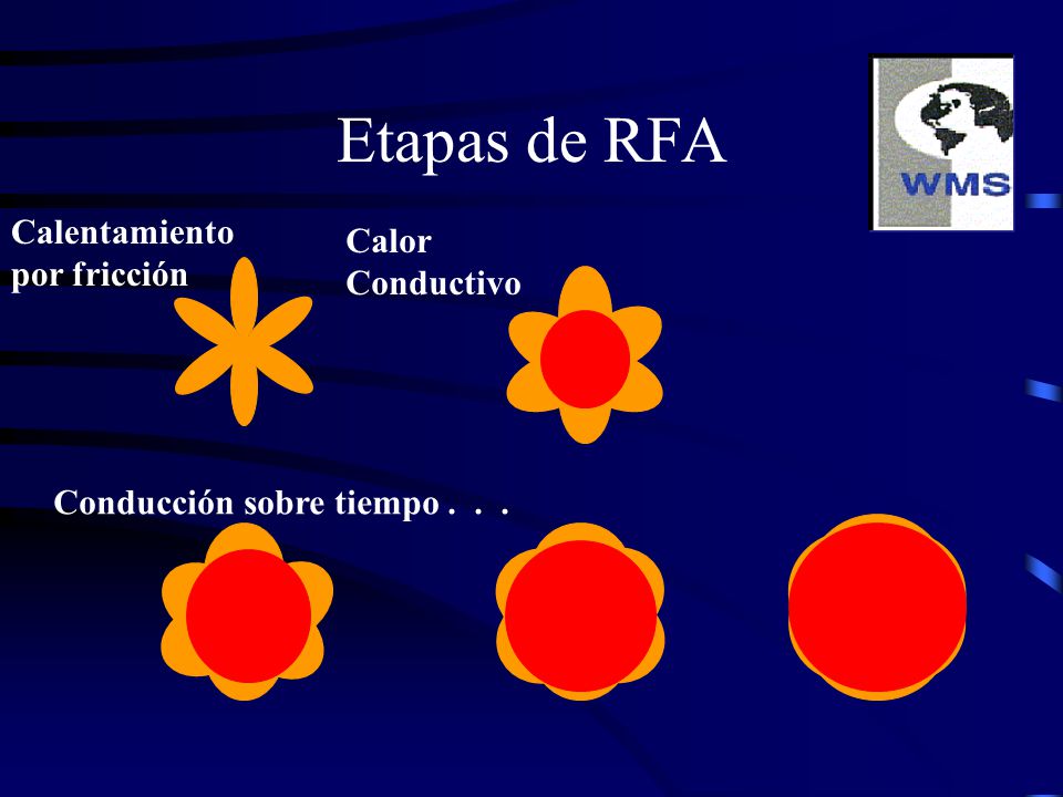 Etapas de RFA Calentamiento Calor por fricción Conductivo