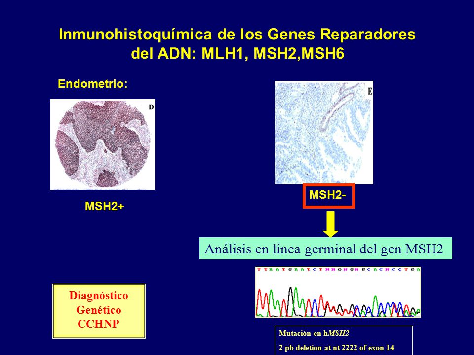 Inmunohistoquímica de los Genes Reparadores del ADN: MLH1, MSH2,MSH6