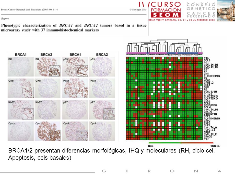 BRCA1/2 presentan diferencias morfológicas, IHQ y moleculares (RH, ciclo cel,