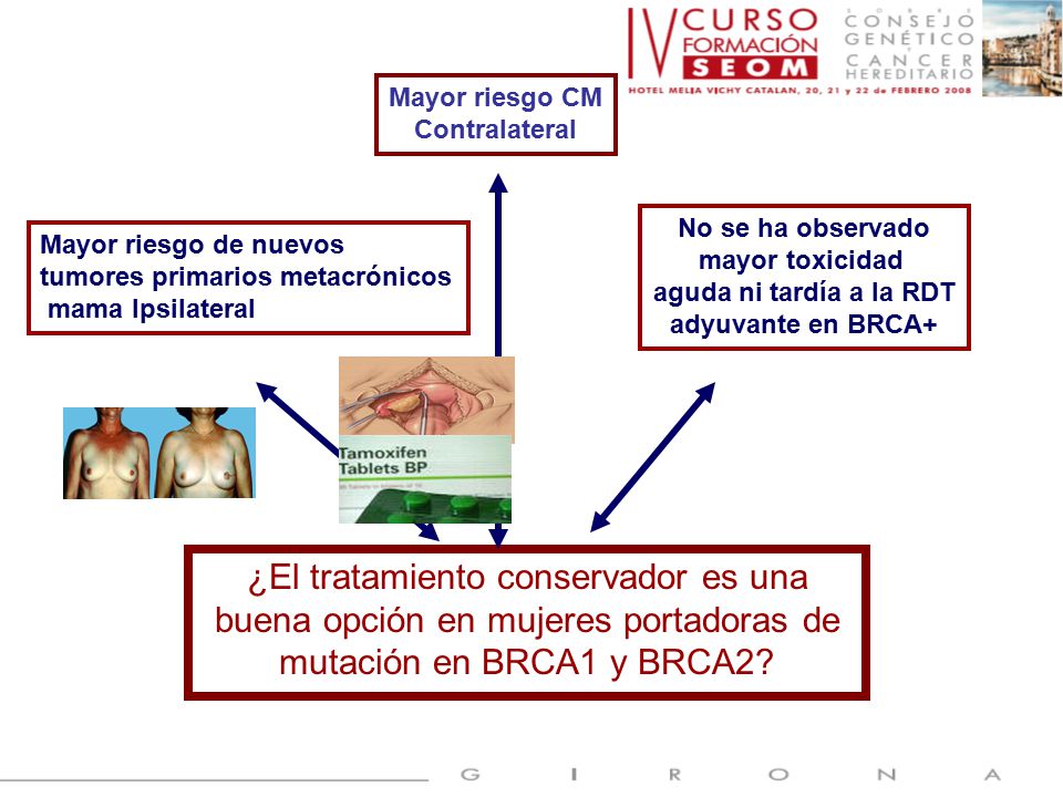 Mayor riesgo CM Contralateral. No se ha observado. mayor toxicidad. aguda ni tardía a la RDT. adyuvante en BRCA+