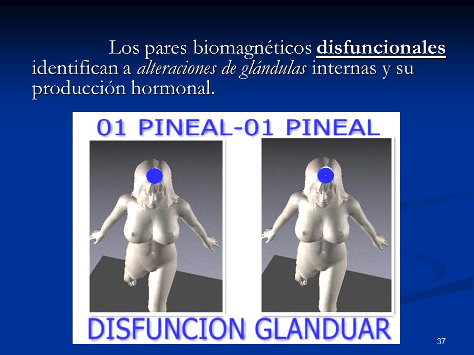 Los pares biomagnéticos disfuncionales identifican a alteraciones de glándulas internas y su producción hormonal.