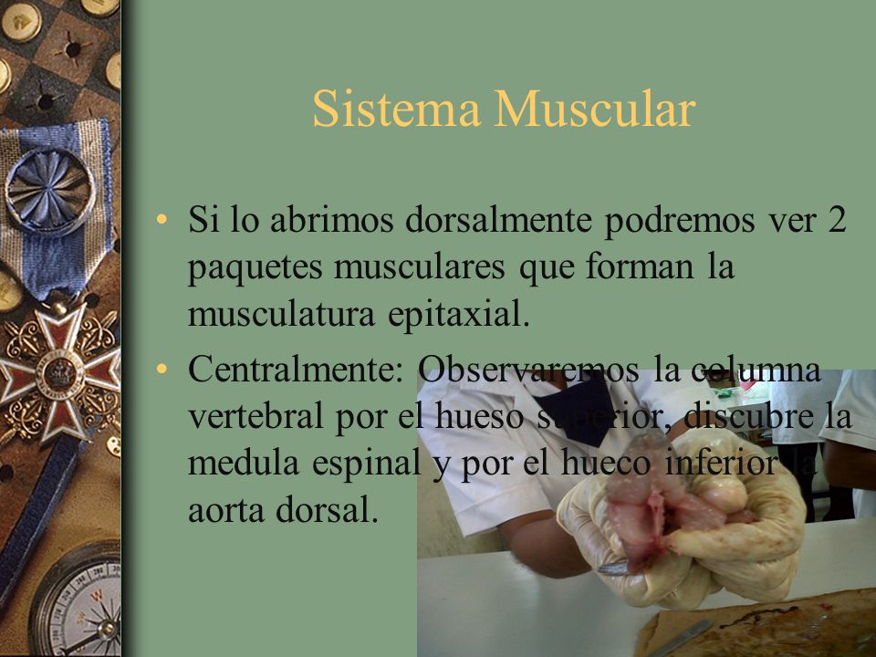 Sistema Muscular Si lo abrimos dorsalmente podremos ver 2 paquetes musculares que forman la musculatura epitaxial.