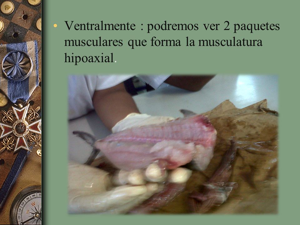 Ventralmente : podremos ver 2 paquetes musculares que forma la musculatura hipoaxial.