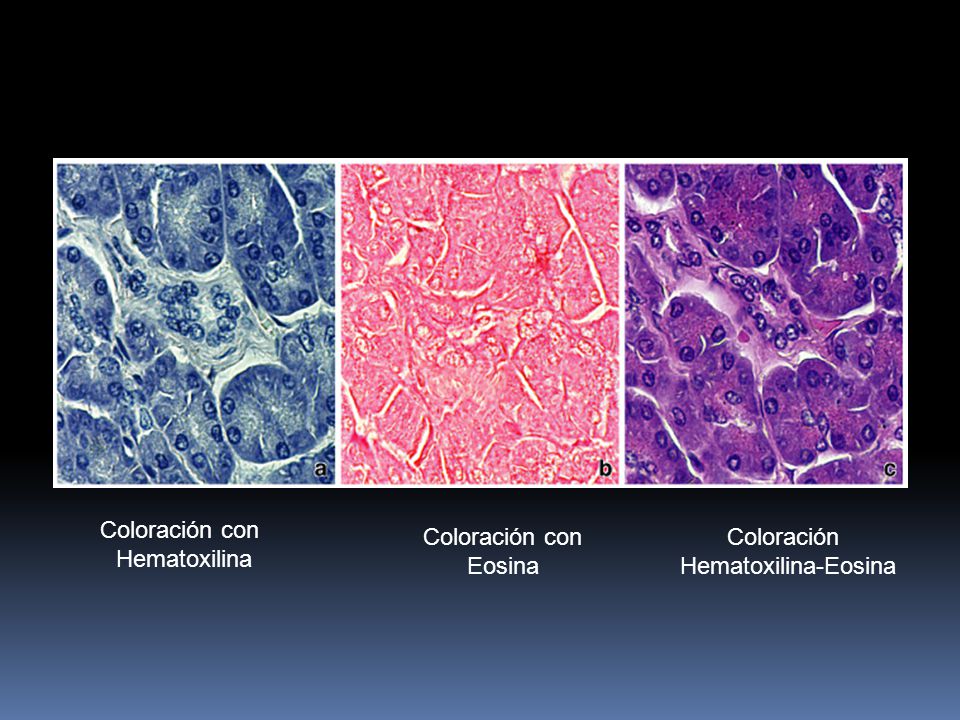 Coloración con Hematoxilina Coloración con Eosina Coloración Hematoxilina-Eosina