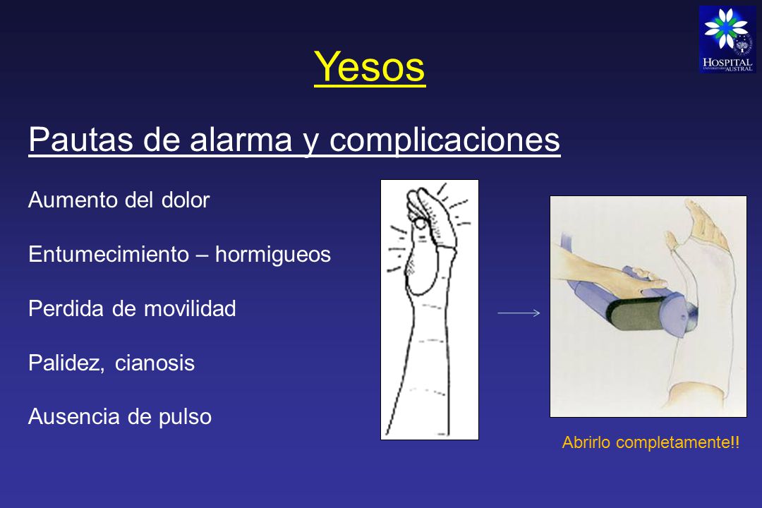 Yesos Pautas de alarma y complicaciones Aumento del dolor