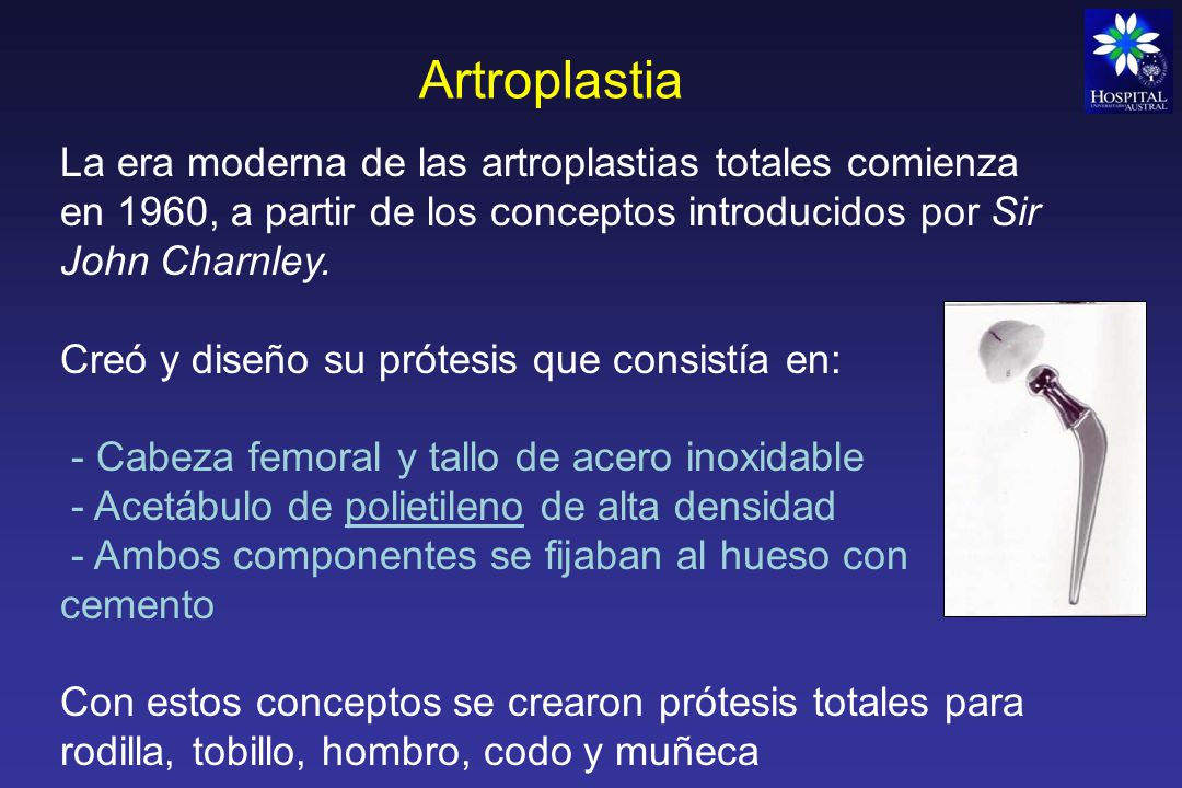Artroplastia La era moderna de las artroplastias totales comienza en 1960, a partir de los conceptos introducidos por Sir John Charnley.