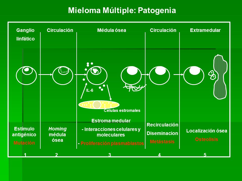 Mieloma Múltiple: Patogenia