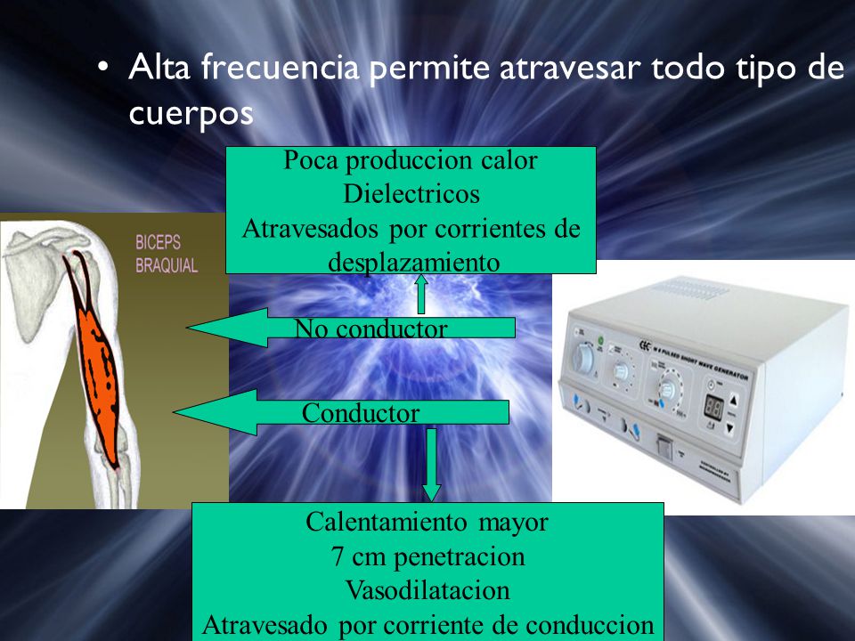 Alta frecuencia permite atravesar todo tipo de cuerpos
