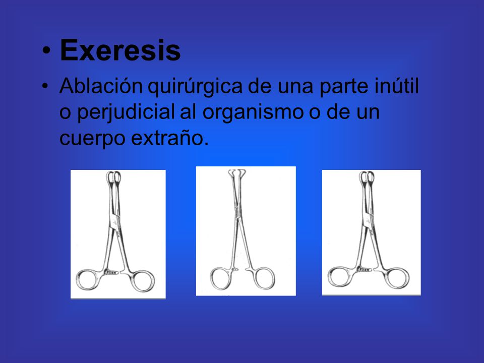 Exeresis Ablación quirúrgica de una parte inútil o perjudicial al organismo o de un cuerpo extraño.