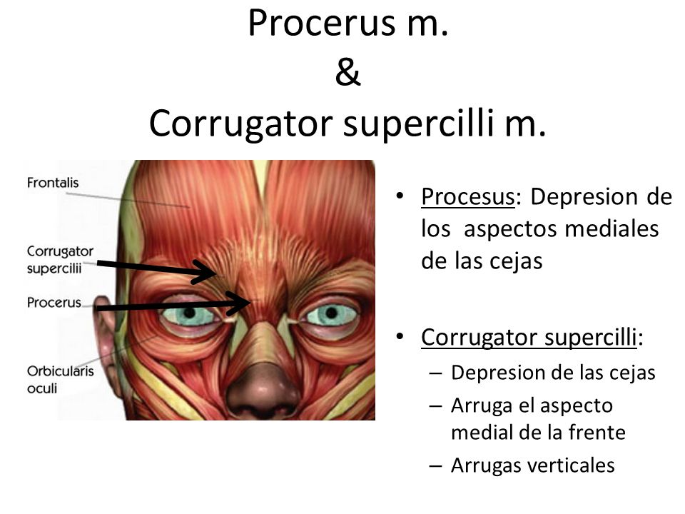 Procerus m. & Corrugator supercilli m.