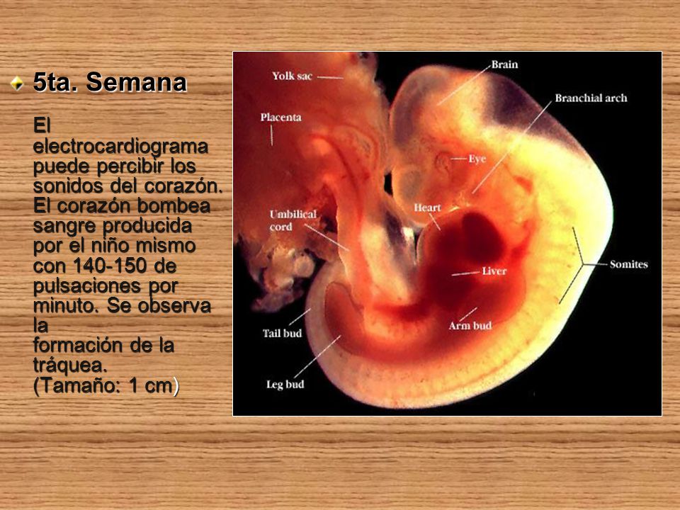 5ta. Semana El electrocardiograma puede percibir los sonidos del corazón.