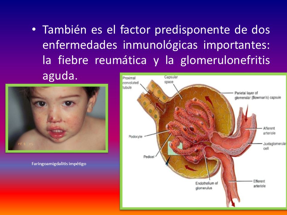 También es el factor predisponente de dos enfermedades inmunológicas importantes: la fiebre reumática y la glomerulonefritis aguda.