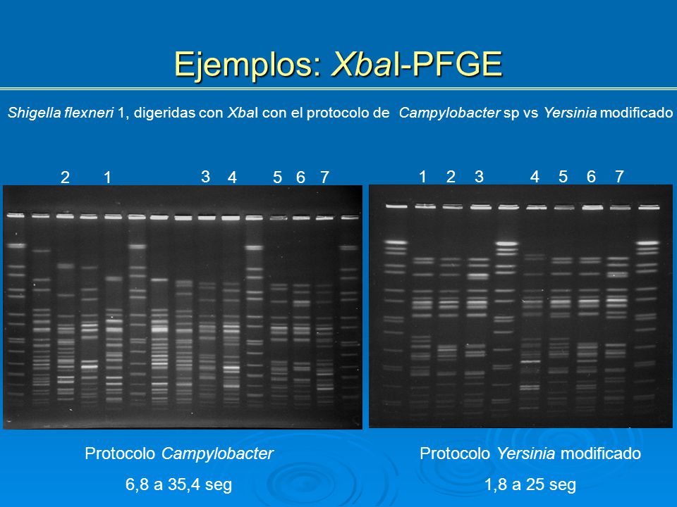 Ejemplos: XbaI-PFGE Shigella flexneri 1, digeridas con XbaI con el protocolo de Campylobacter sp vs Yersinia modificado.