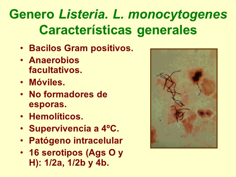 Genero Listeria. L. monocytogenes Características generales