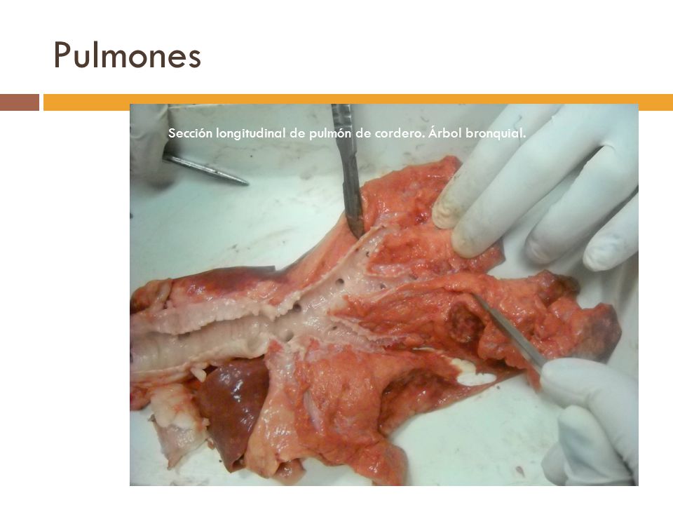 Pulmones Sección longitudinal de pulmón de cordero. Árbol bronquial.
