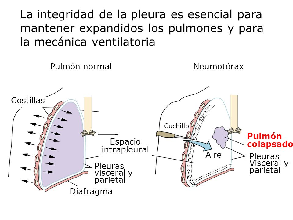 La integridad de la pleura es esencial para mantener expandidos los pulmones y para la mecánica ventilatoria