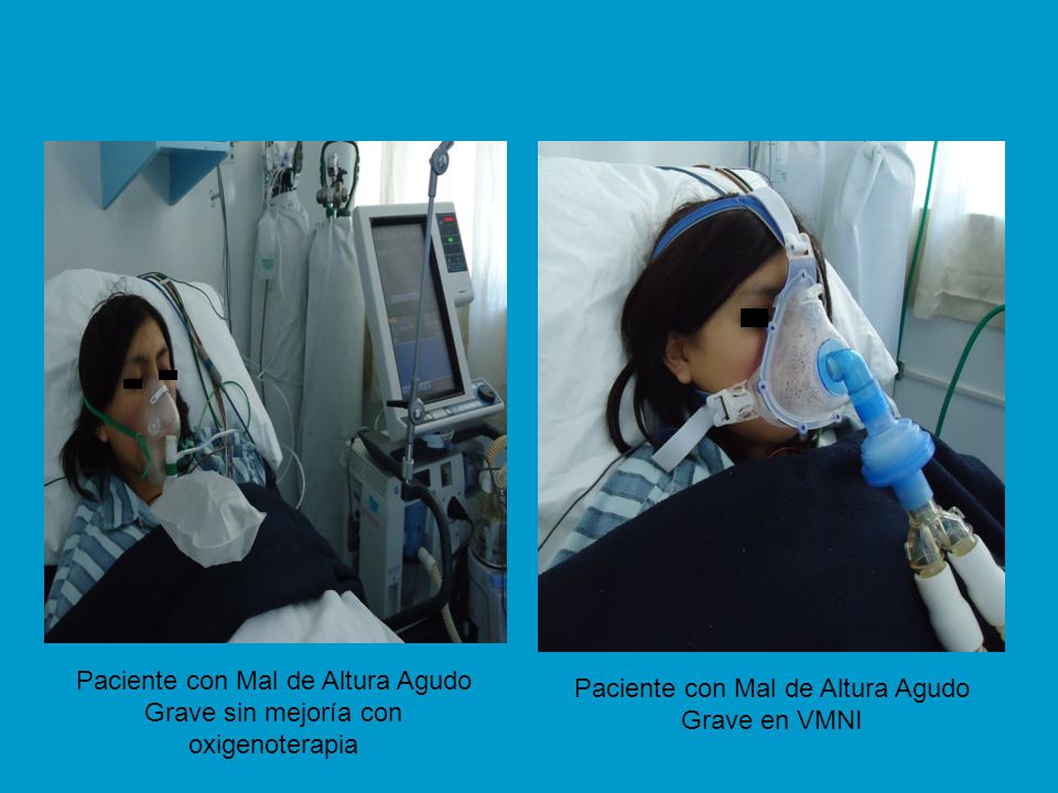 Paciente con Mal de Altura Agudo Grave sin mejoría con oxigenoterapia