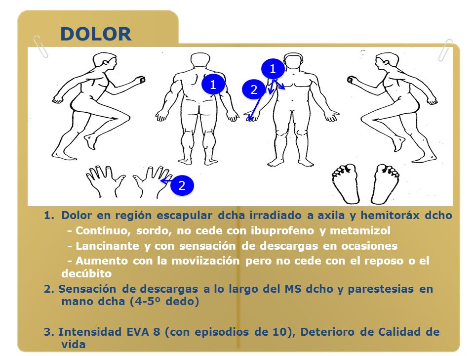 DOLOR Dolor en región escapular dcha irradiado a axila y hemitoráx dcho. - Contínuo, sordo, no cede con ibuprofeno y metamizol.