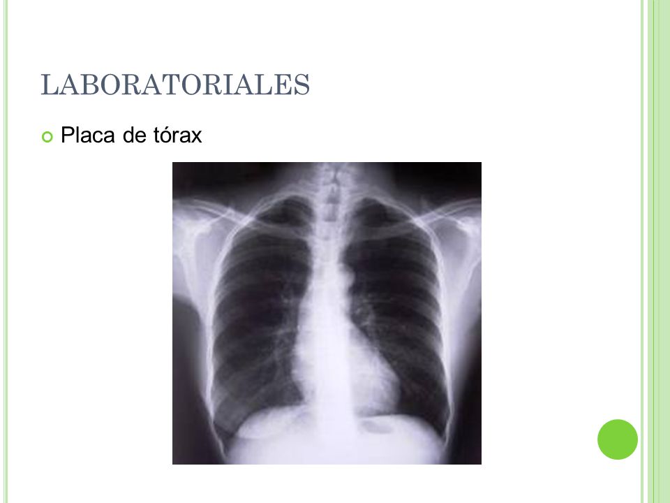 LABORATORIALES Placa de tórax