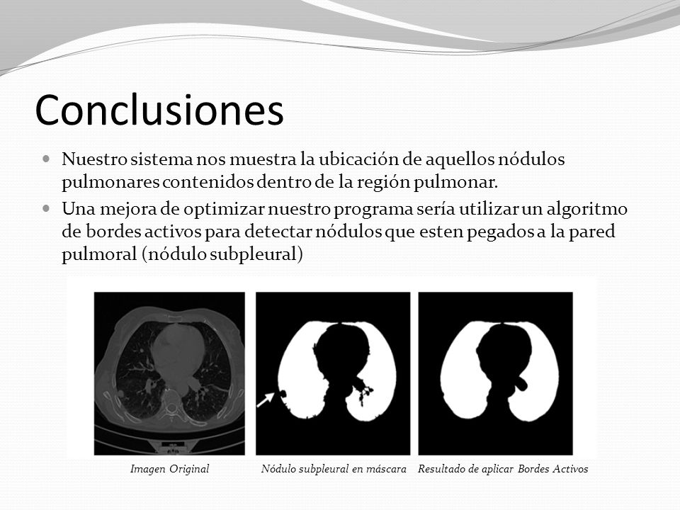 Conclusiones Nuestro sistema nos muestra la ubicación de aquellos nódulos pulmonares contenidos dentro de la región pulmonar.