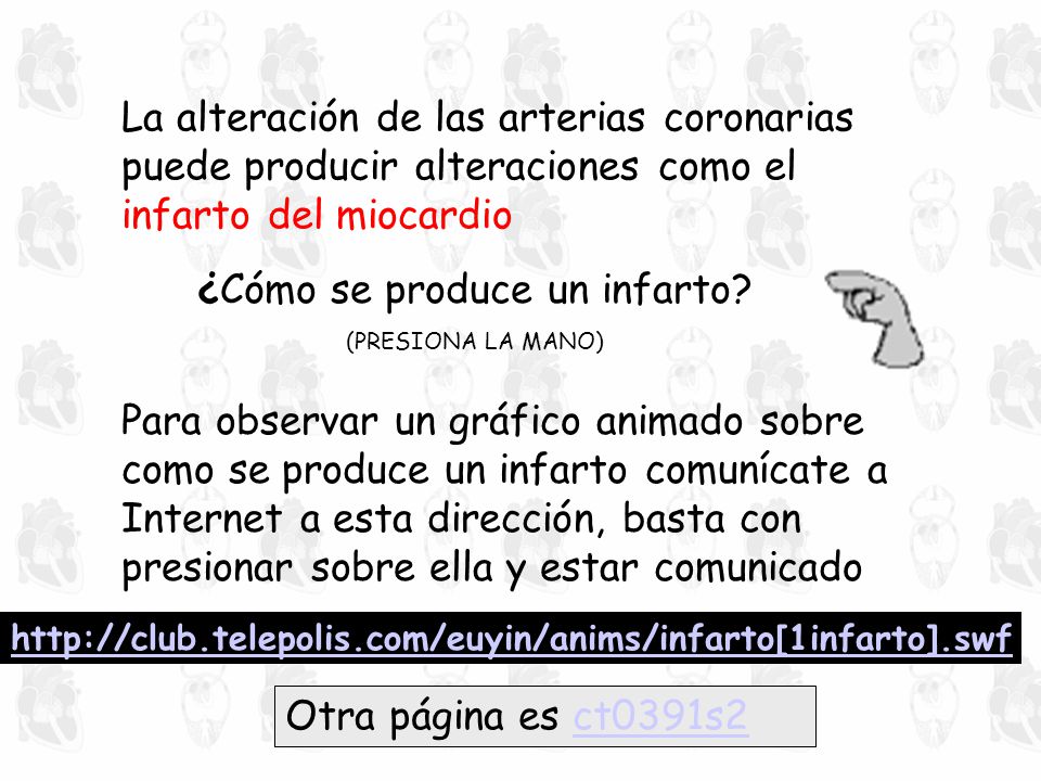 ¿Cómo se produce un infarto