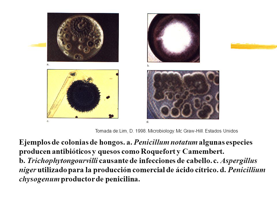 Ejemplos de colonias de hongos. a. Penicillum notatum algunas especies