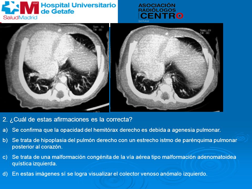 2. ¿Cuál de estas afirmaciones es la correcta