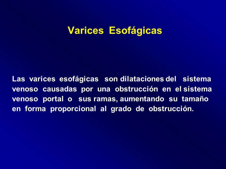 Varices Esofágicas Las varices esofágicas son dilataciones del sistema
