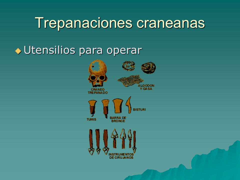 Trepanaciones craneanas