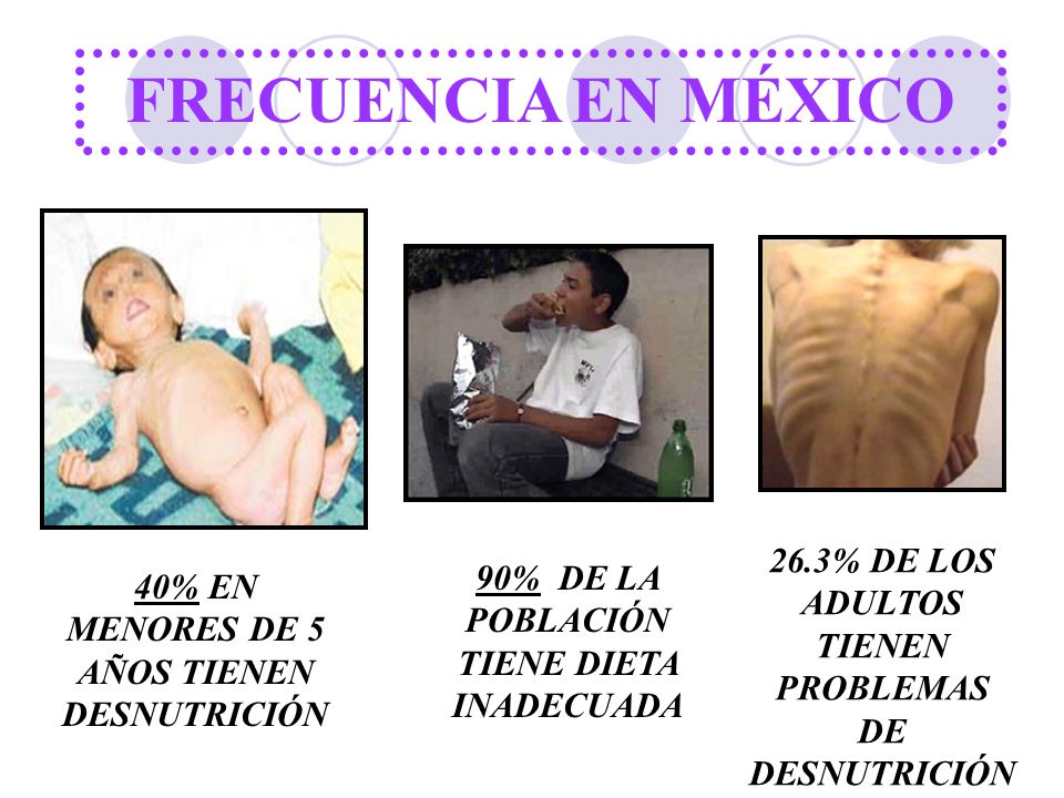 FRECUENCIA EN MÉXICO 26.3% DE LOS ADULTOS TIENEN PROBLEMAS DE DESNUTRICIÓN. 90% DE LA POBLACIÓN TIENE DIETA INADECUADA.