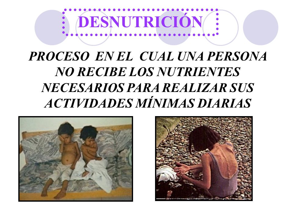 DESNUTRICIÓN PROCESO EN EL CUAL UNA PERSONA NO RECIBE LOS NUTRIENTES NECESARIOS PARA REALIZAR SUS ACTIVIDADES MÍNIMAS DIARIAS.