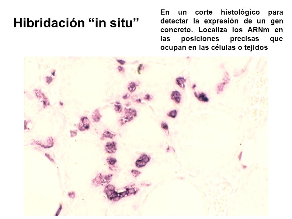 En un corte histológico para detectar la expresión de un gen concreto