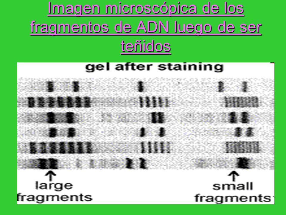 Imagen microscópica de los fragmentos de ADN luego de ser teñidos
