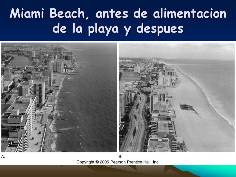 Miami Beach, antes de alimentacion de la playa y despues