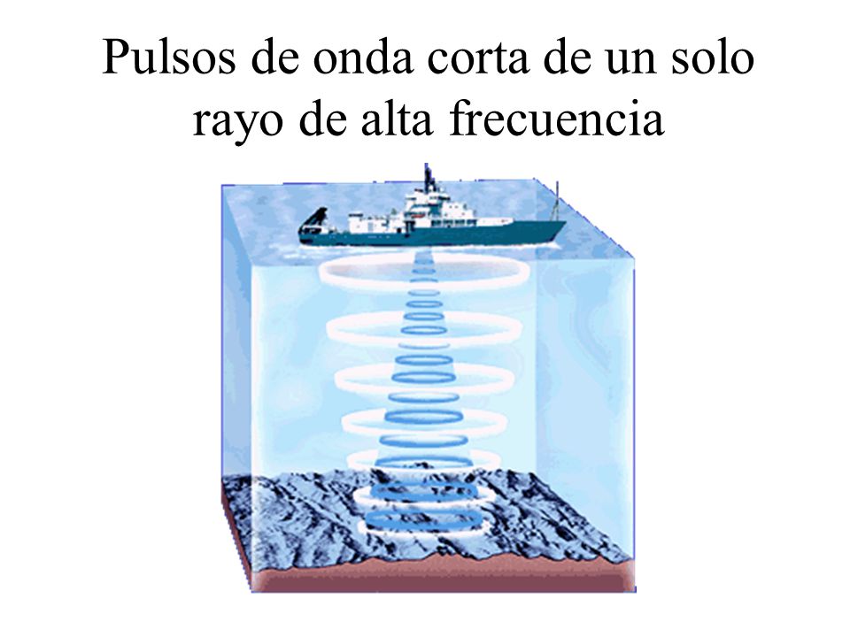 Pulsos de onda corta de un solo rayo de alta frecuencia