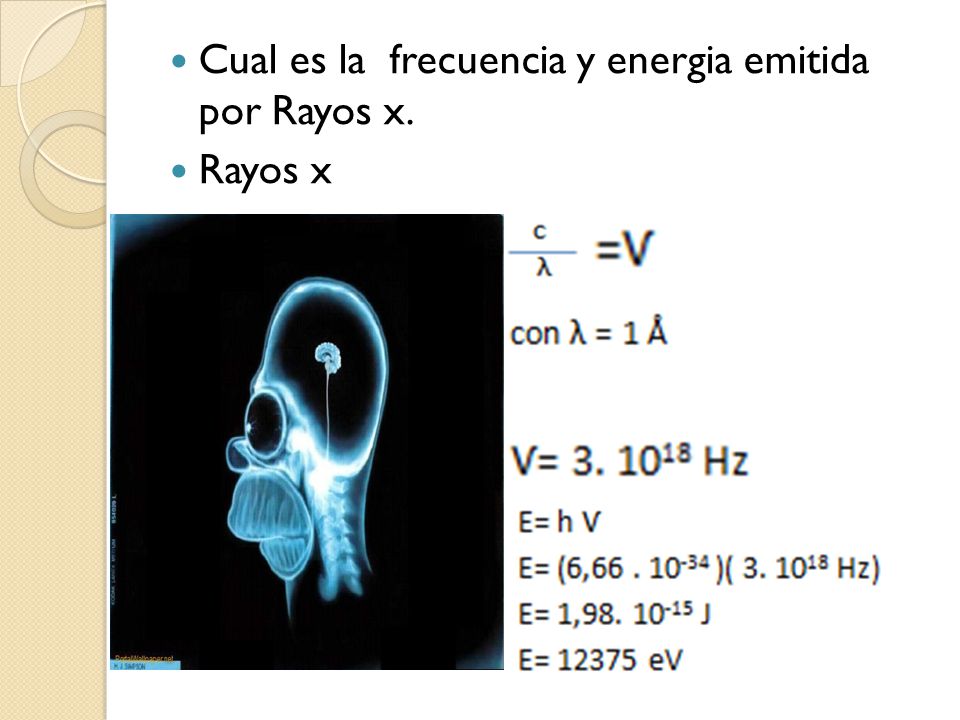 Cual es la frecuencia y energia emitida por Rayos x.