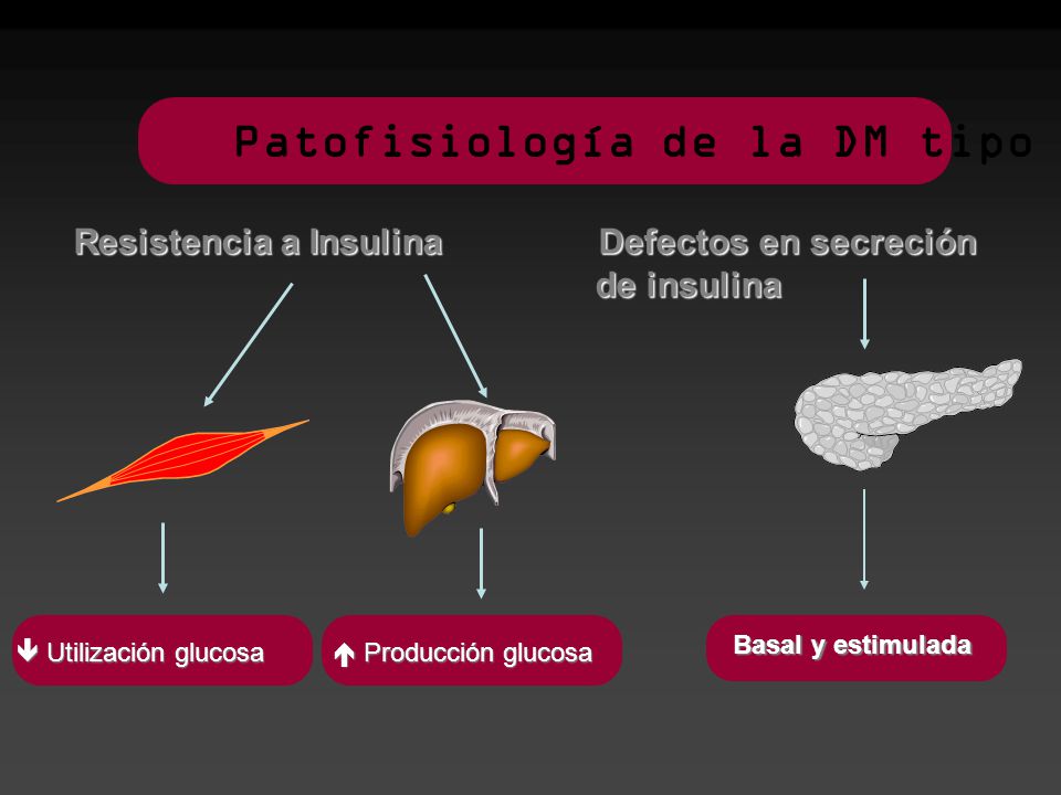 Patofisiología de la DM tipo 2