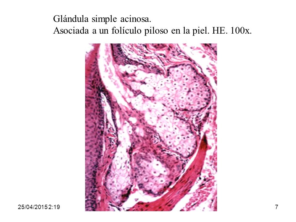 Glándula simple acinosa. Asociada a un folículo piloso en la piel. HE
