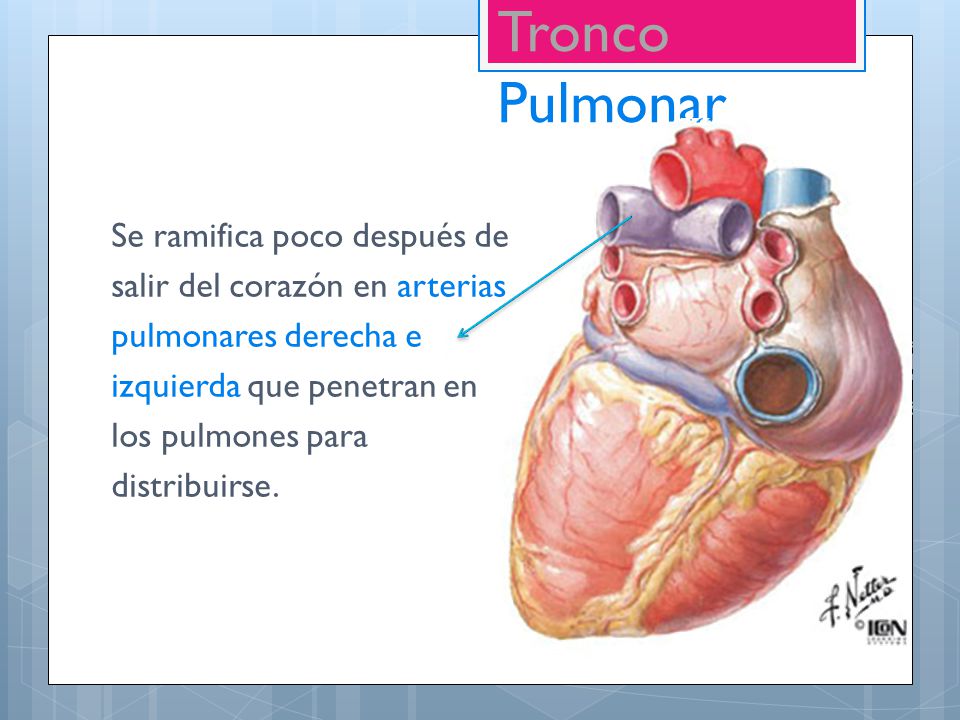 Tronco Pulmonar