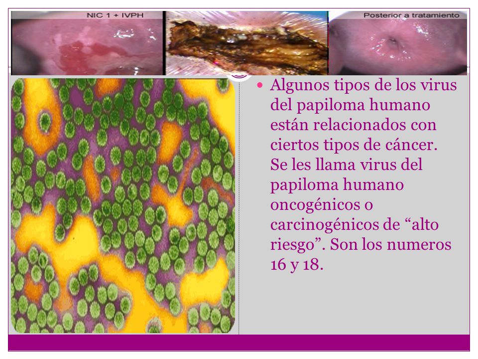 Algunos tipos de los virus del papiloma humano están relacionados con ciertos tipos de cáncer.