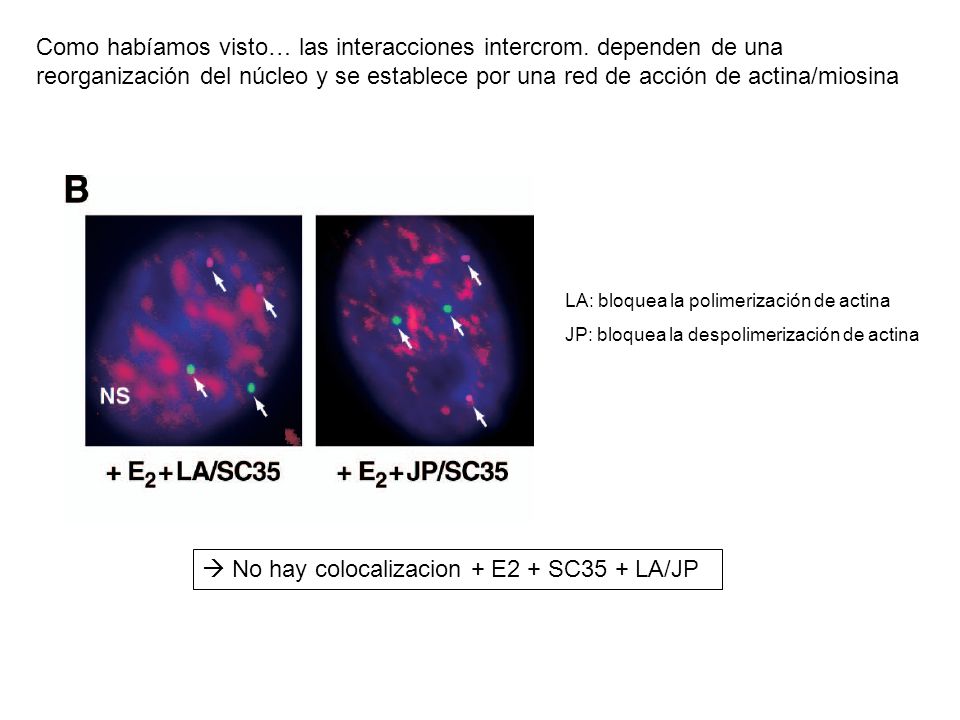  No hay colocalizacion + E2 + SC35 + LA/JP