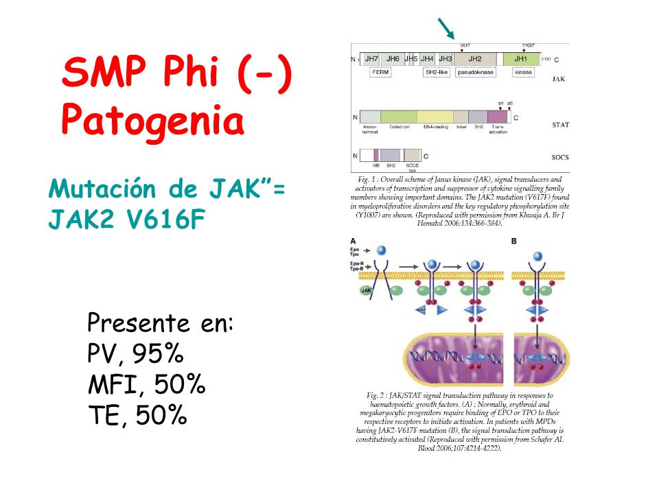 SMP Phi (-) Patogenia Mutación de JAK = JAK2 V616F Presente en: