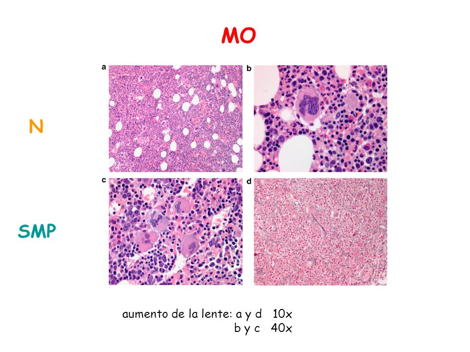 MO N SMP aumento de la lente: a y d 10x b y c 40x
