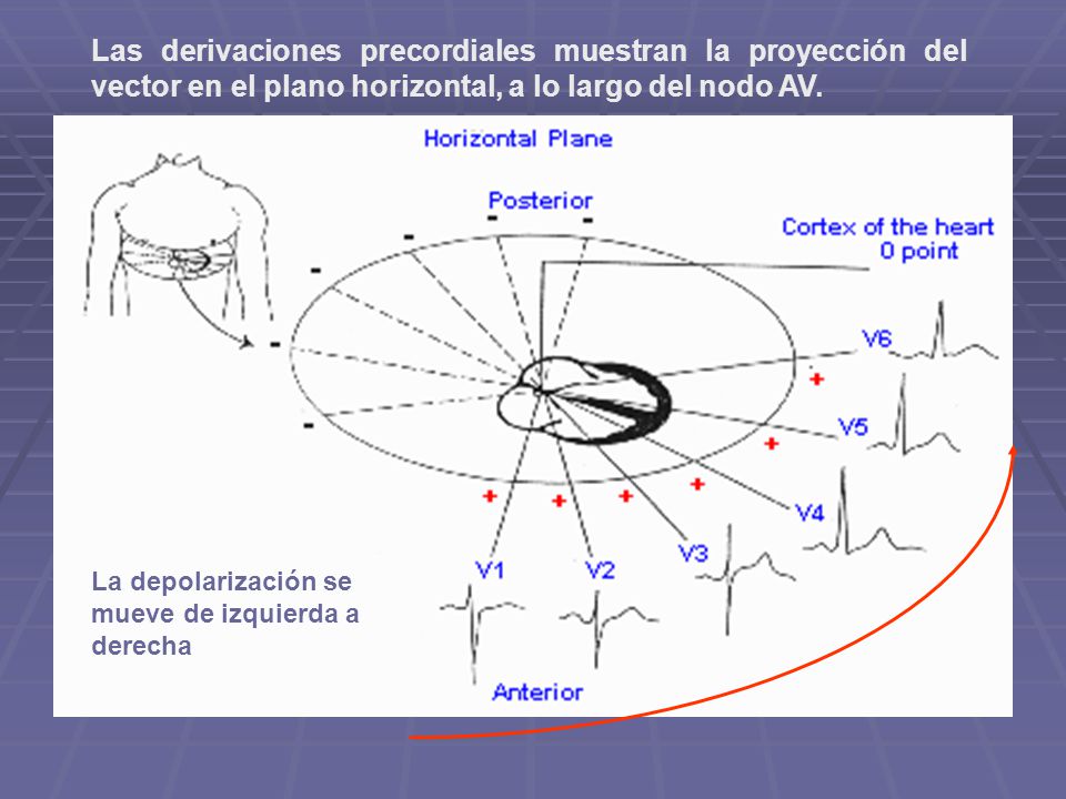 Las derivaciones precordiales muestran la proyección del vector en el plano horizontal, a lo largo del nodo AV.