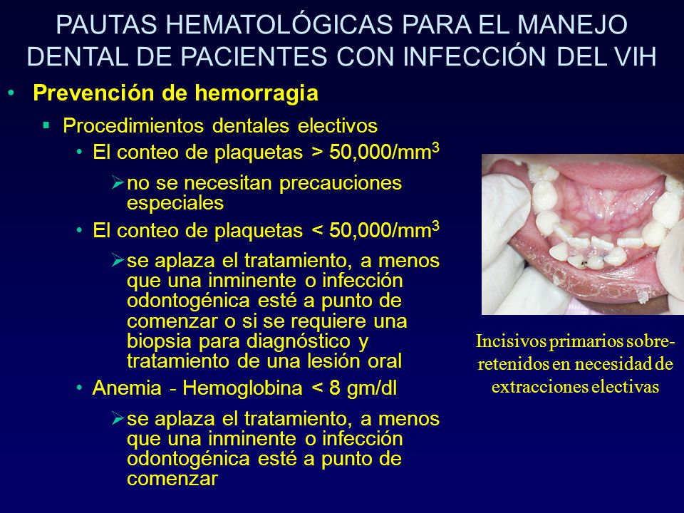 PAUTAS HEMATOLÓGICAS PARA EL MANEJO DENTAL DE PACIENTES CON INFECCIÓN DEL VIH