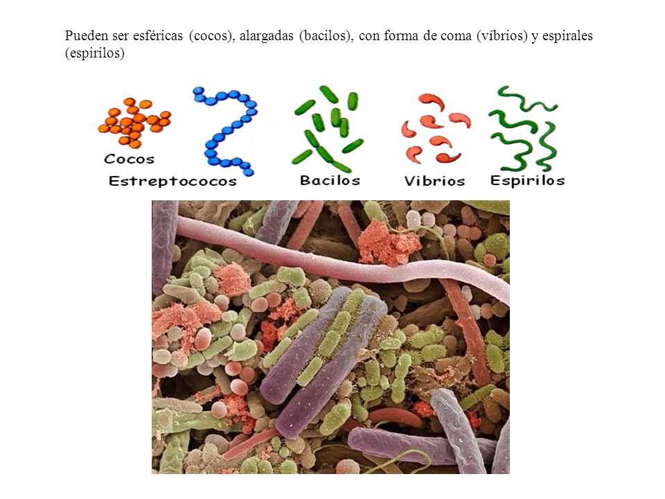Pueden ser esféricas (cocos), alargadas (bacilos), con forma de coma (víbrios) y espirales (espirilos)