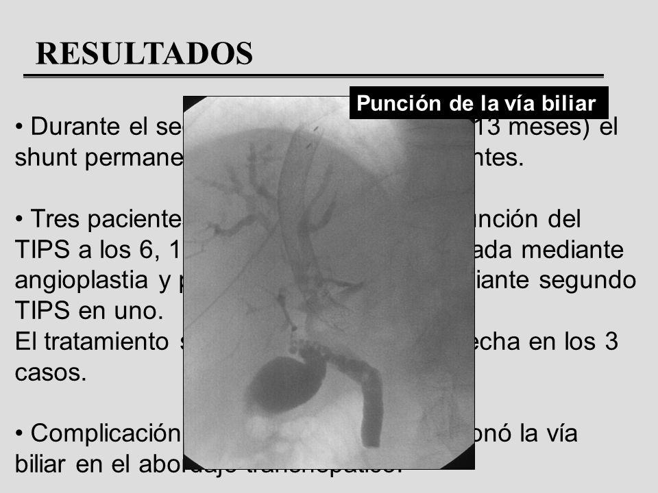 RESULTADOS Punción de la vía biliar. Durante el seguimiento (media: 17,8 ± 13 meses) el shunt permaneció permeable en 5 pacientes.