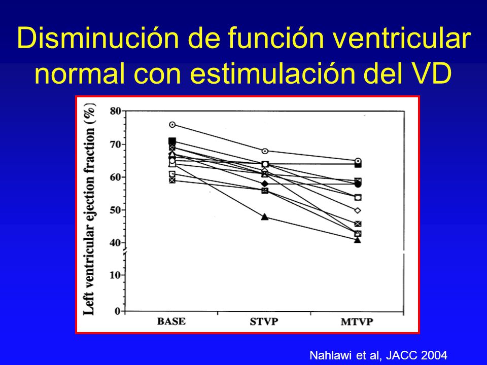 Disminución de función ventricular normal con estimulación del VD