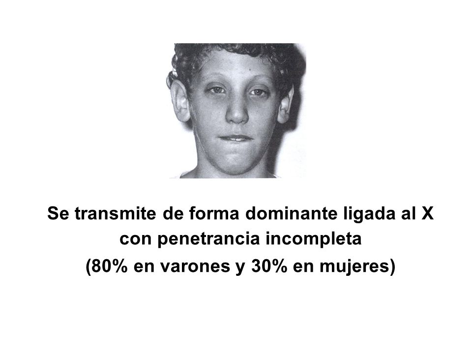 Se transmite de forma dominante ligada al X con penetrancia incompleta