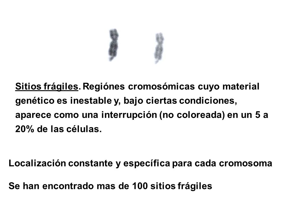 Sitios frágiles. Regiónes cromosómicas cuyo material genético es inestable y, bajo ciertas condiciones, aparece como una interrupción (no coloreada) en un 5 a 20% de las células.